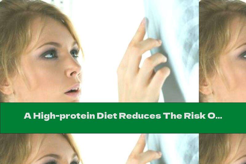 A High-protein Diet Reduces The Risk Of Fractures By 50%