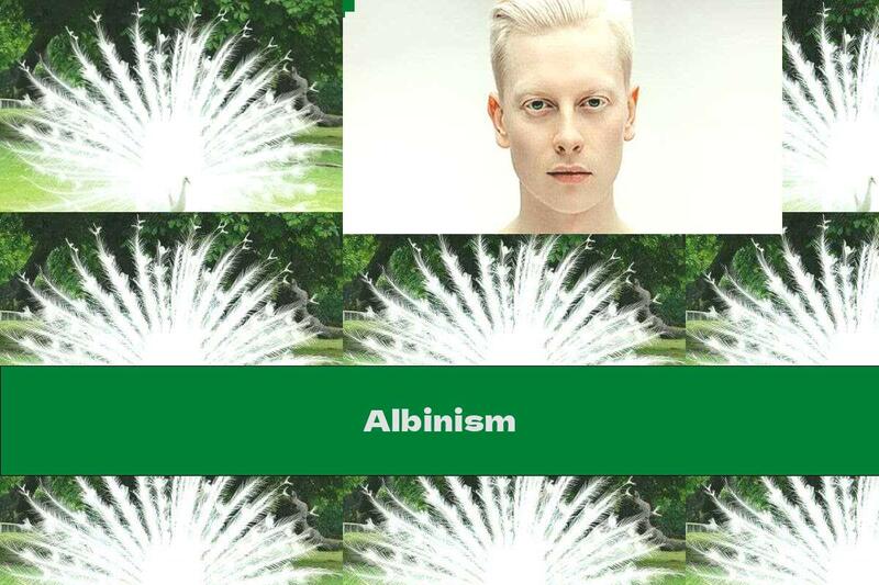 Albinism