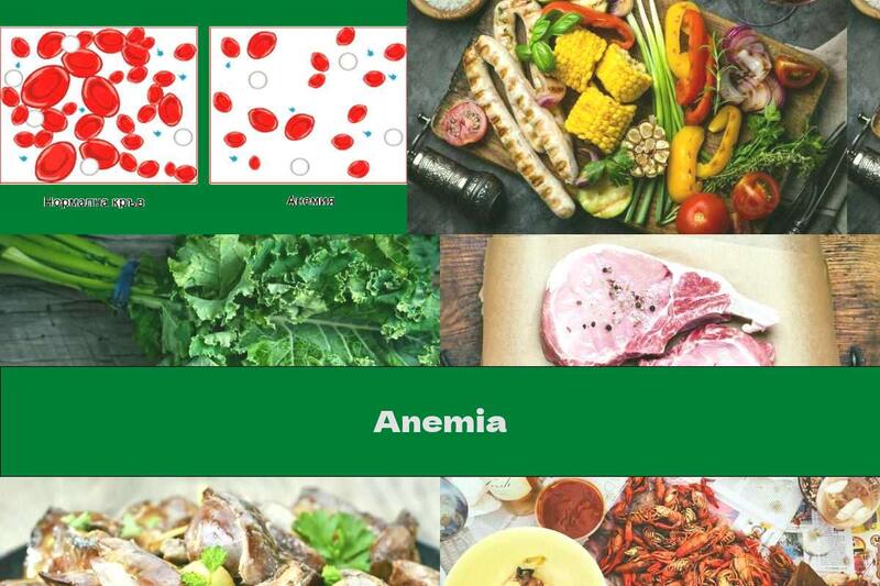 Anemia