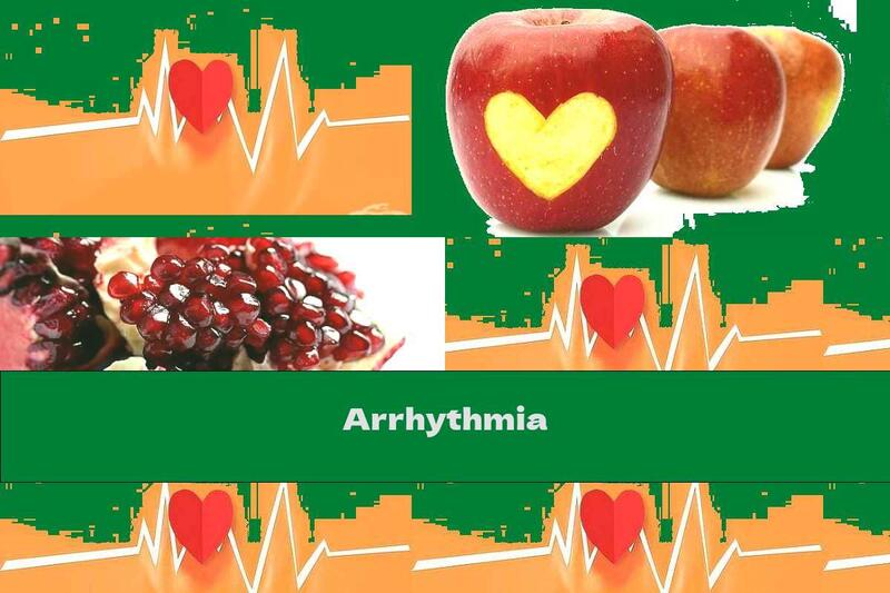 Arrhythmia