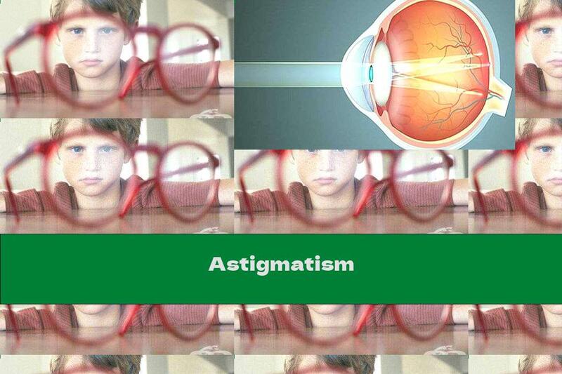 Astigmatism