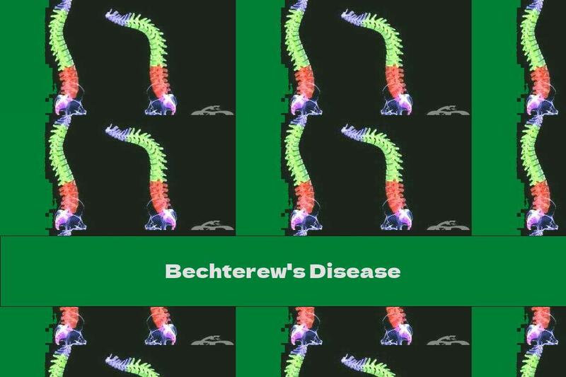Bechterew's Disease