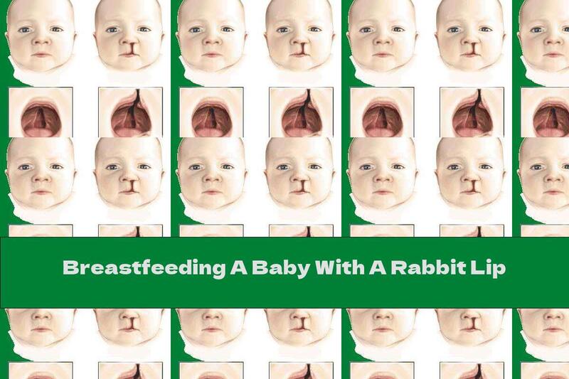 Breastfeeding A Baby With A Rabbit Lip