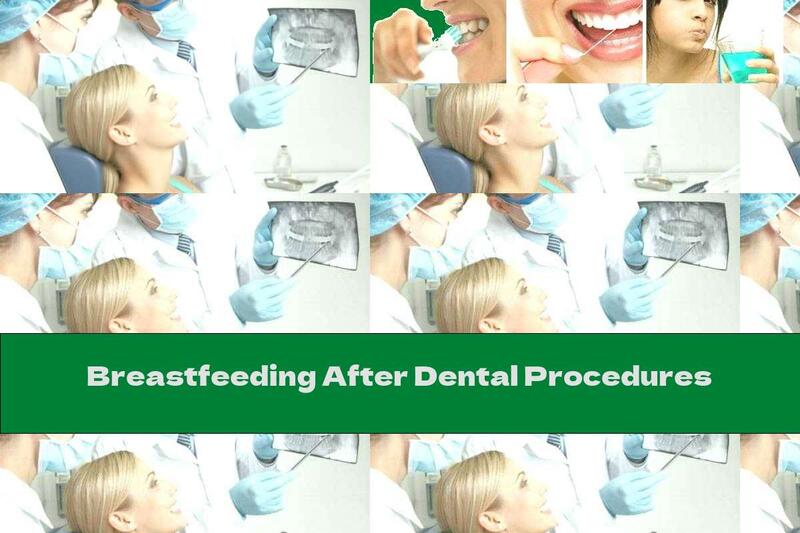 Breastfeeding After Dental Procedures