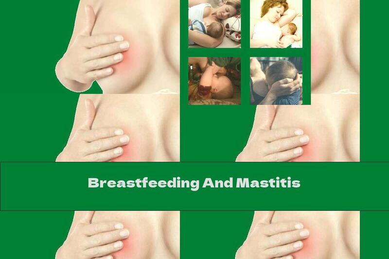 Breastfeeding And Mastitis