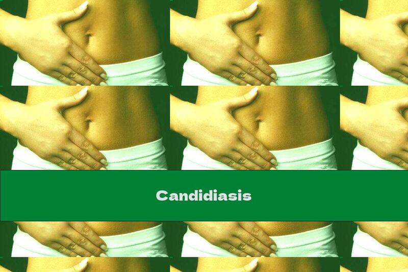 Candidiasis
