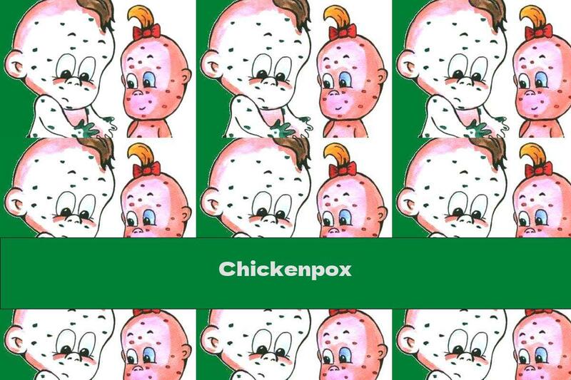 Chickenpox