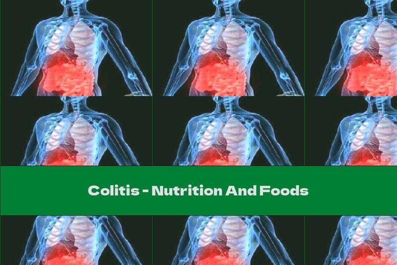 Colitis - Nutrition And Foods
