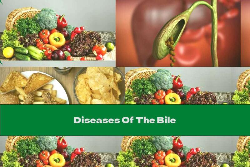 Diseases Of The Bile