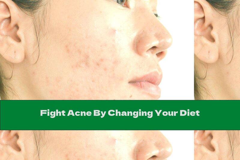Fight Acne By Changing Your Diet