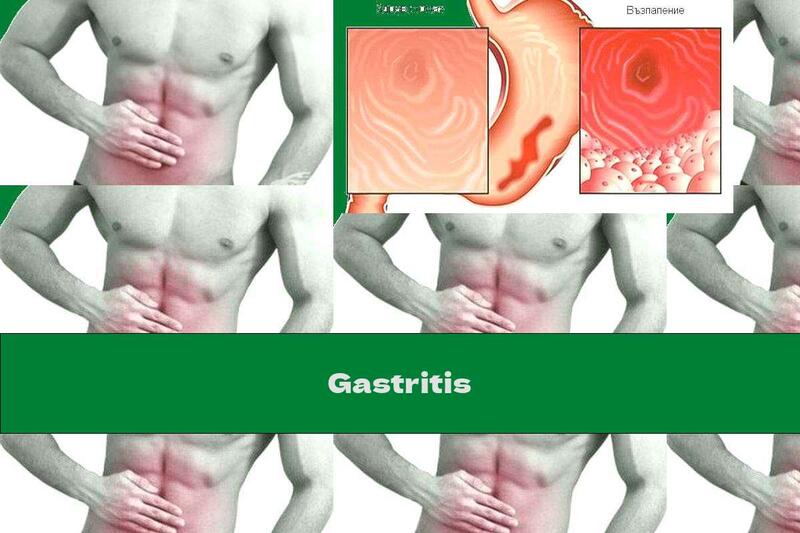 Gastritis