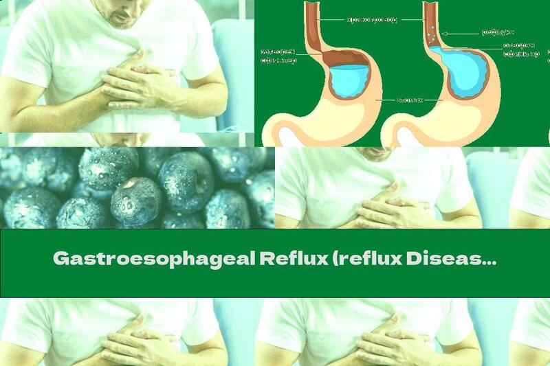 Gastroesophageal Reflux (reflux Disease, Heartburn, Acid Reflux, GERD)