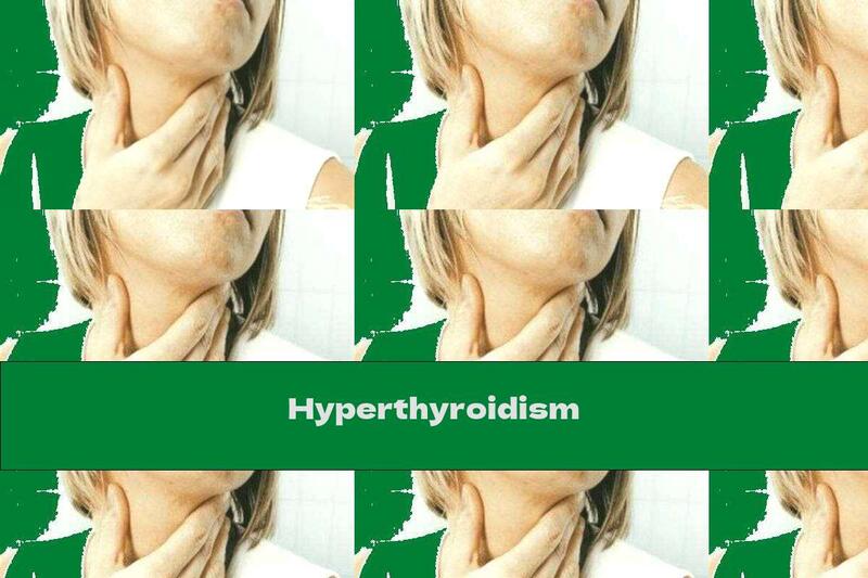 Hyperthyroidism