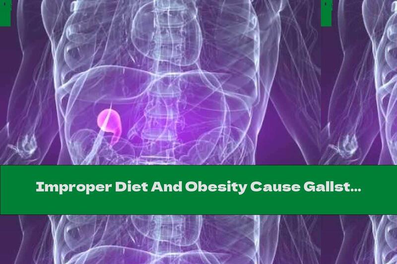 Improper Diet And Obesity Cause Gallstones (part II)