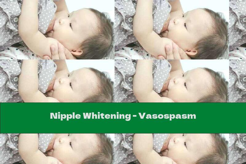 Nipple Whitening - Vasospasm
