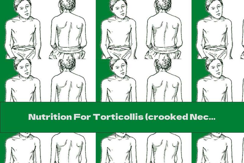 Nutrition For Torticollis (crooked Neck)