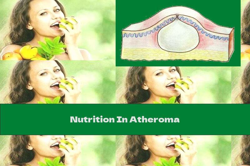 Nutrition In Atheroma