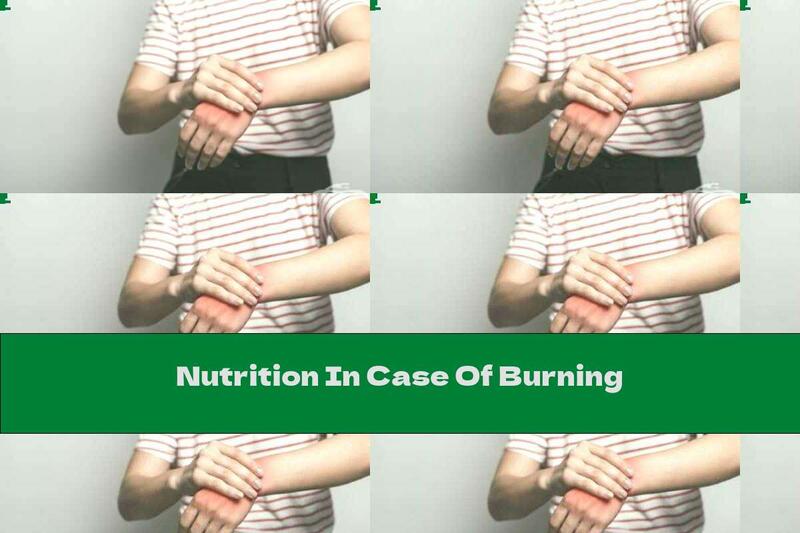 Nutrition In Case Of Burning