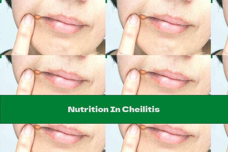 Nutrition In Cheilitis