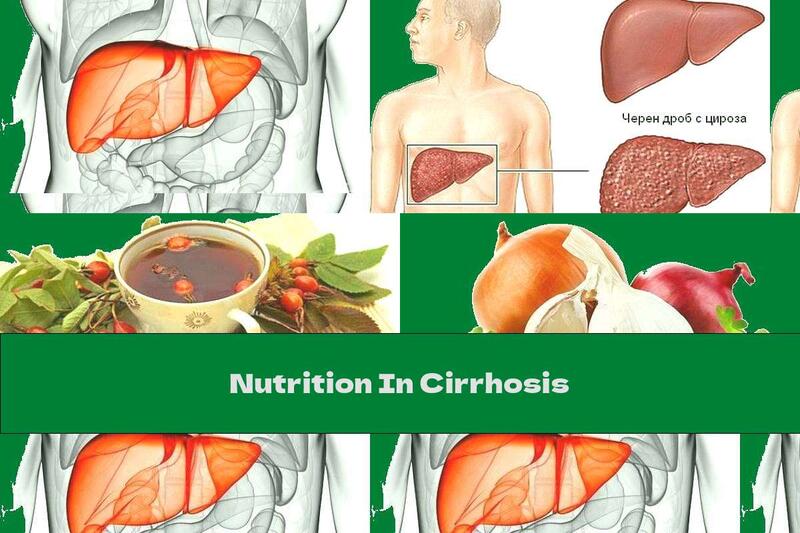 Nutrition In Cirrhosis