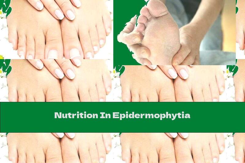Nutrition In Epidermophytia