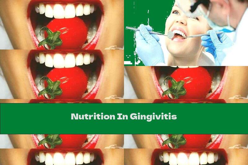 Nutrition In Gingivitis