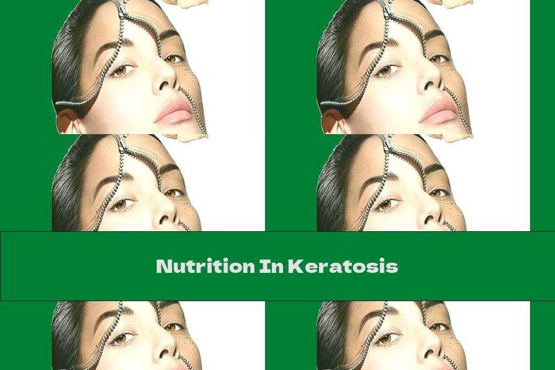 Nutrition In Keratosis