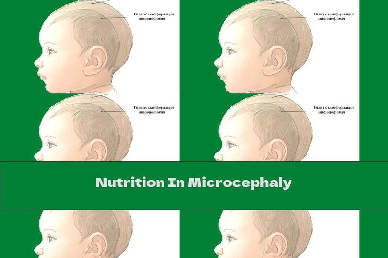 Nutrition In Microcephaly