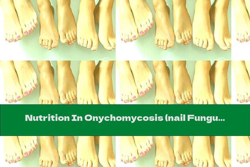 Nutrition In Onychomycosis (nail Fungus)