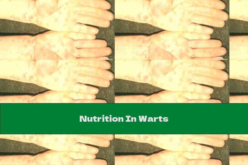 Nutrition In Warts