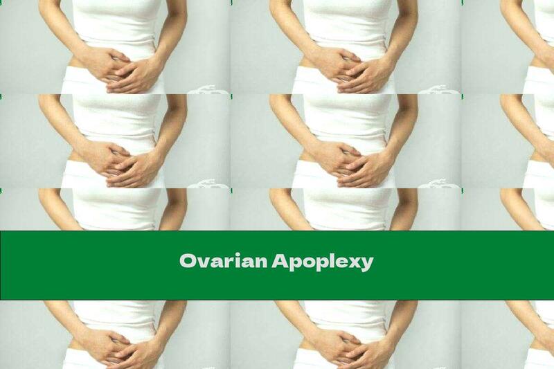 Ovarian Apoplexy