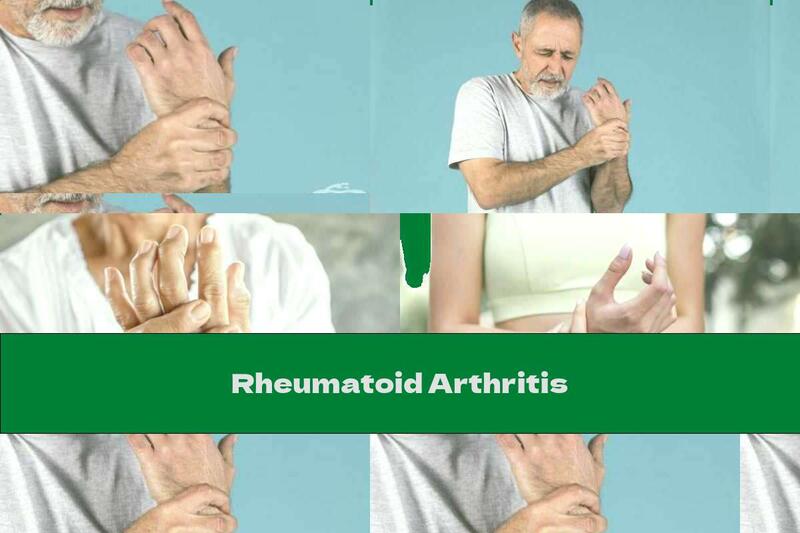 Rheumatoid Arthritis