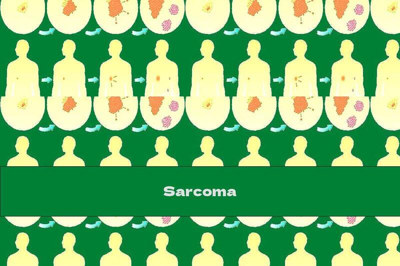 Sarcoma