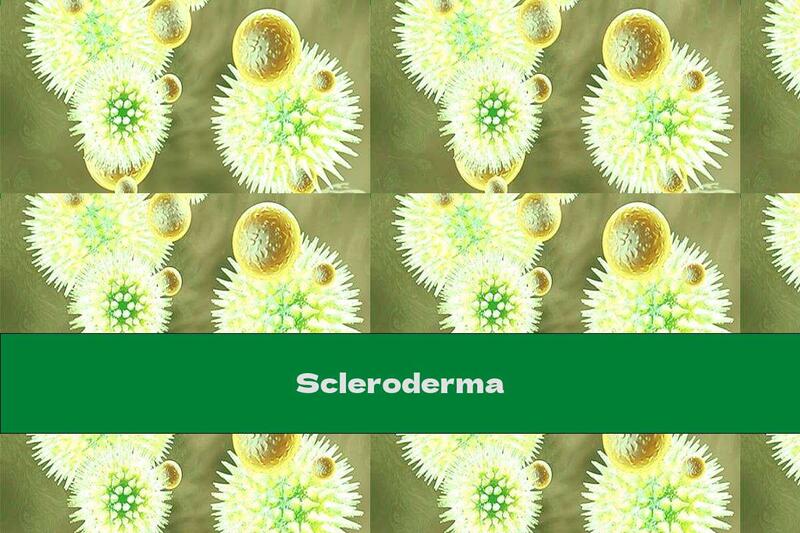 Scleroderma