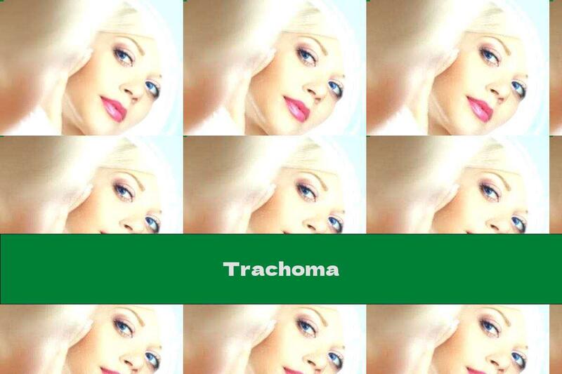 Trachoma